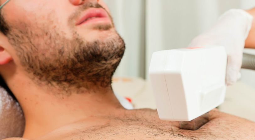 guia-depilacion-masculina-como-depilarse-con-fotodepilacion-luz-pulsada